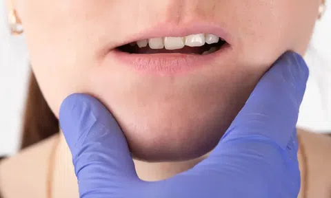 Mất răng ảnh hưởng thế nào đến khớp cắn? Đâu là phương pháp khắc phục?