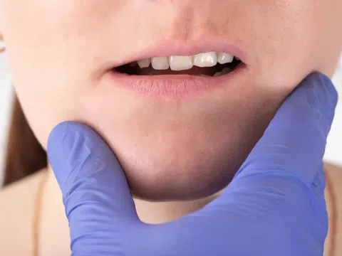 Mất răng ảnh hưởng thế nào đến khớp cắn? Đâu là phương pháp khắc phục?